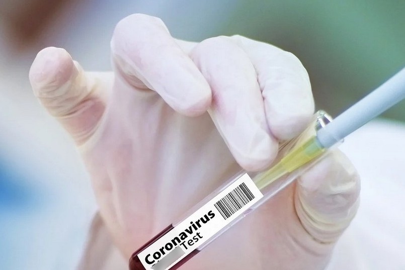 О заболеваемости коронавирусом в Старом Осколе и Белгородской области на 25 июня
