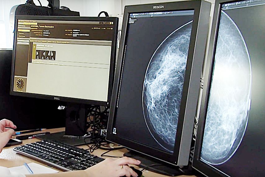 Жительницы Старого Оскола бесплатно сделали первую маммографию