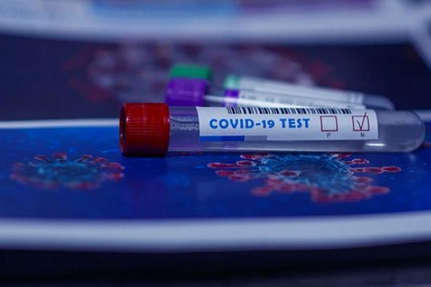 В Белгородской области 73 новых заболевших коронавирусной инфекцией