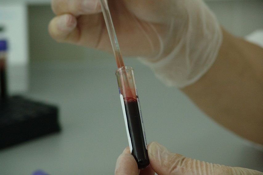 Старооскольский округ лидирует по заболевшим ВИЧ при употреблении наркотиков