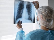 Советы врача: как уберечься от рака лёгких